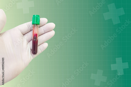 Blood test in the laboratory,The doctor's hands are wearing gloves and holding a clotted blood tube to collect a sample for testing in the laboratory.Health service concept and medical technology.