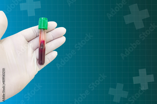 Blood test in the laboratory,The doctor's hands are wearing gloves and holding a clotted blood tube to collect a sample for testing in the laboratory.Health service concept and medical technology.
