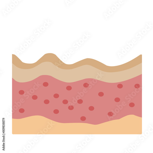 Human Skin Layer Illustration 