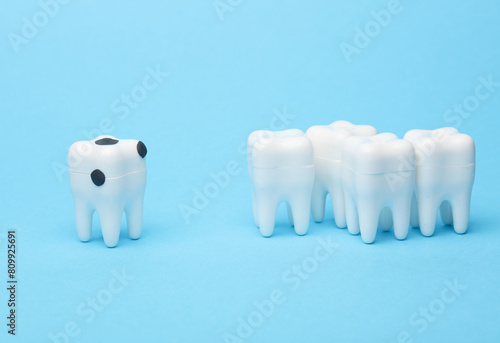 Model of a tooth affected by caries on blue background. Dental treatment