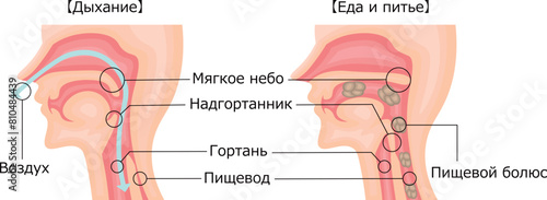 飲食　呼吸　嚥下性無呼吸　イラスト　ロシア語