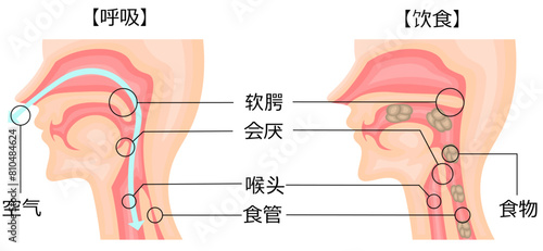 飲食　呼吸　嚥下性無呼吸　イラスト　中国語