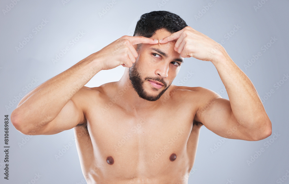 Skincare, pimple and man in studio with hands to check blemish, acne and mark for facial treatment. Dermatology, salon and closeup of person for cosmetics, beauty and wellness on white background Skincare, pimple and man in studio with hands to check blemish, acne and mark for facial treatment. Dermatology, salon and closeup of person for cosmetics, beauty and wellness on white background
