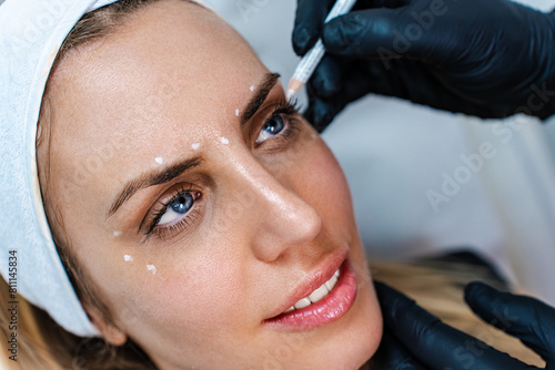 Beautiful brunette woman patient preparing for medical and beauty treatment with botulinum toxin injections or hyaluronic acid fillers. Doctors marks her face with correction lines and dots.