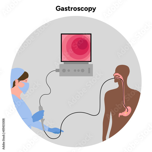 Gastroscopy procedure with doctor and patient 