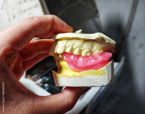 denture