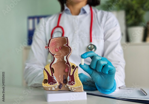 Medical suppository with laxative medicine or for treatment of proctological diseases concept
