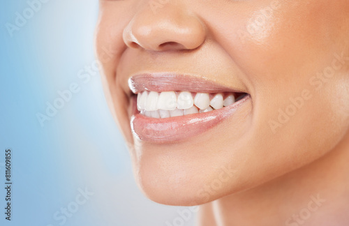 Female person  smile and zoom for treatment  filling and polish for cosmetic in blue background. Teeth  closeup and dental with hygiene  mouth and oral care for health  wellness and clean in studio