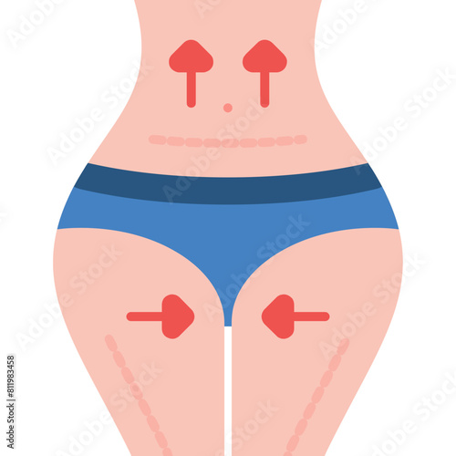 Abdominoplasty Icon
