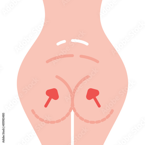 Aesthetic Surgery Icon