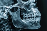 X-ray of the human skull and teeth