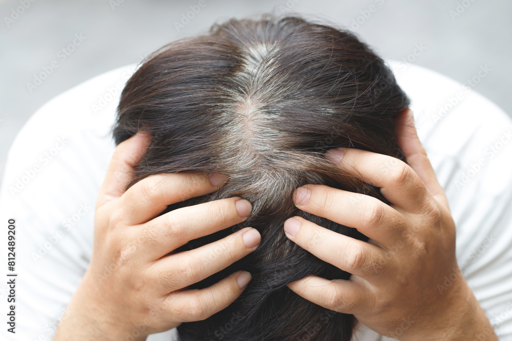 Top view of young people premature gray hair, showing black hoary hair roots on head change to senior old man outdoor. Top view of young people premature gray hair, showing black hoary hair roots on head change to senior old man outdoor.