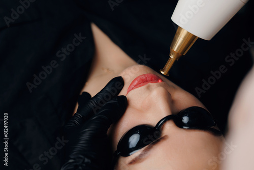 Laser removal of tattoo permanent makeup red color from lips of woman in salon