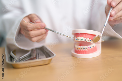 Dentist with Orthodontic tooth model and bracket or brace. Clean and Scrape off tartar. May Orthodontic Health Day, March Oral health, Dentist Day, False Teeth. Toothache and Children Dental Health