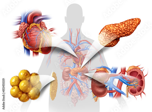 Cardiovascular kidney metabolic syndrome as a multisystem disorder as disease related to a group of organs as kidneys heart pancreas and Adipose cells. photo
