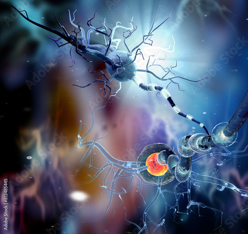 Illustration of  Nerve cells, Neuron, Neurologic Disease, tumors, brain surgery. 3d Illustration