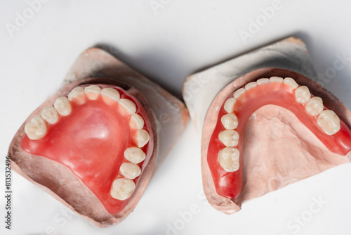 ceramic dental dentures of the upper and lower jaws .  Upper and lower jaws with fake teeth. Dentures or false teeth