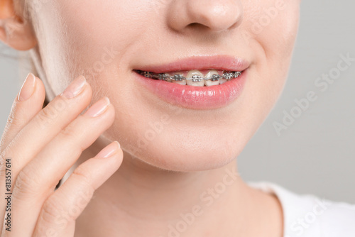 Smiling woman with dental braces on grey background  closeup