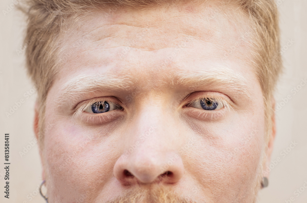 Close up portrait of an albino latino man Close up portrait of an albino latino man