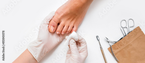 Pedicure, podologist. Patient on medical pedicure procedure, nail disease, cholesis detachment of the nail plate. Foot care, treatment in a medical spa salon.