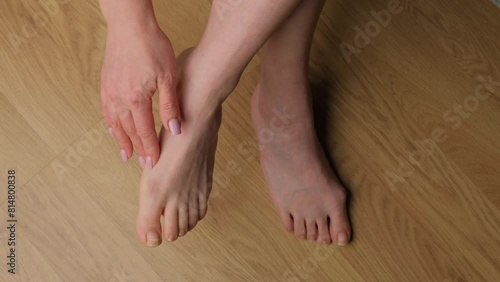 Close-up of a woman's feet with hallux valgus. photo
