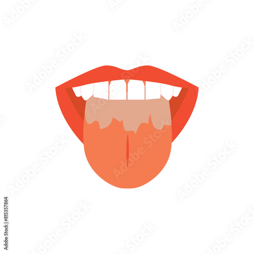 Illustration of tongue symptoms and health