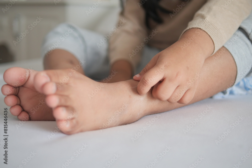 a kid suffering from itching skin on feet a kid suffering from itching skin on feet