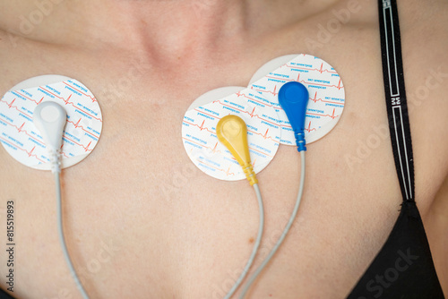 Electrodes on the human body. Holter, heart rhythm studies. The inscription ecg electrode universal.