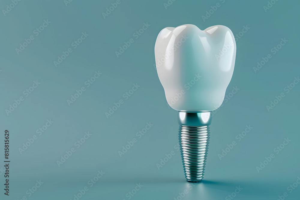 Dental Implant Isolated on background Dental Implant Isolated on background