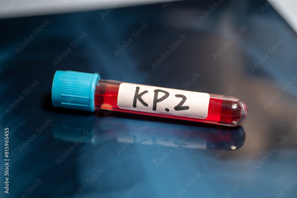 KP.2 is one of several variants being referred to as “FLiRT variants,” named after the technical names for their mutations. KP.2 is one of several variants being referred to as “FLiRT variants,” named after the technical names for their mutations.