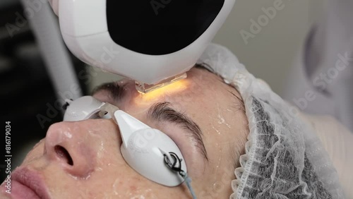 A woman receives IPL therapy in a beauty salon.