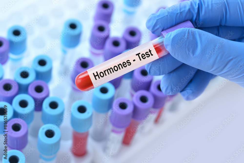 Naklejka premium Doctor holding a test blood sample tube with Hormones test on the background of medical test tubes with analyzes.