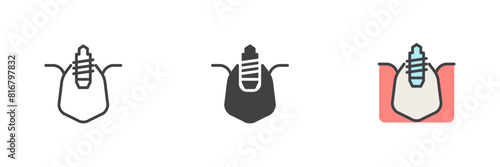 Dental implant different style icon set