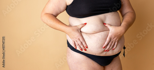 Woman body fat belly. Obese woman hands holding excessive tummy fat. Change diet lifestyle concept to shape up healthy stomach muscle. Studio anonymous shot photo of body parts.
