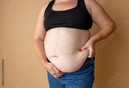 Cropped image of overweight fat woman back with obesity, excess fat. Big size photo