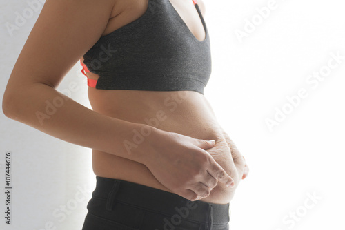 A fat Asian woman in black pants pinches fat folds on her belly with stretch marks after childbirth.