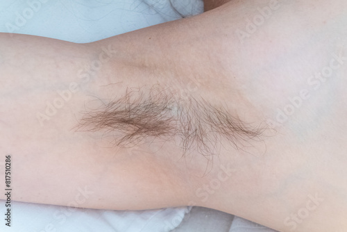 Closeup of long dark hair growing under arm of young female. Concept of hygiene, natural beauty, feminity and body hair growth