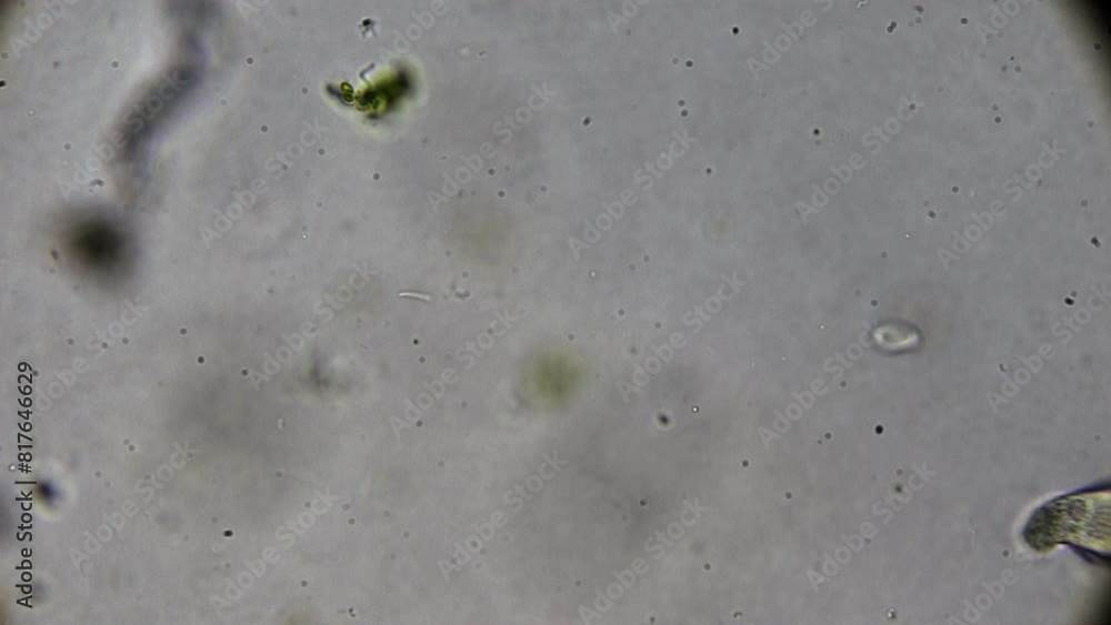Paramesia Microscopic exploration of a water droplet from a natural reservoir ...