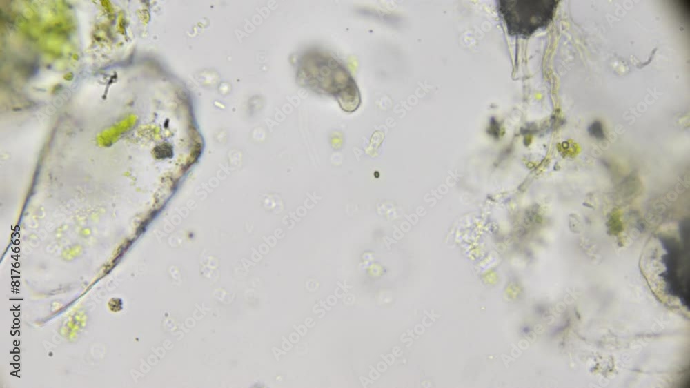 Paramesia Under the microscope, a drop of pond water reveals a dense population ...