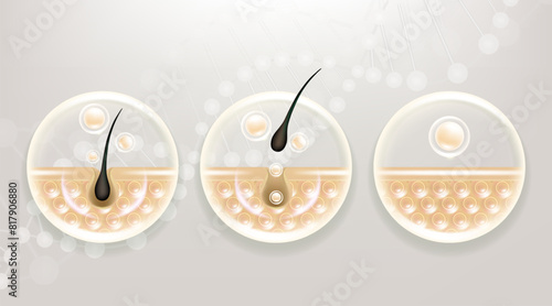 Hyaluronic acid before and after hair removal and skin solutions ad. white collagen serum drop into skin cells with cosmetic advertising background ready to use, illustration vector.