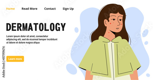 Girl with dermatology problem skin banner. Cartoon scene skin, causes and methods of treating acne.