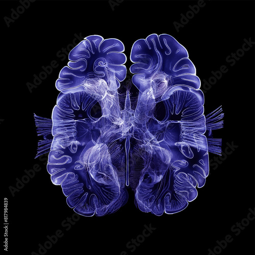 Humen brain  x-ray film on a dark background, top view, Healthcare and medicine concept.