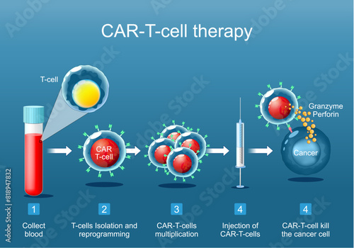 CAR T-cell therapy. cancer immunotherapy