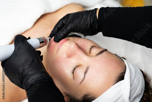 A close-up cosmetologist manipulates a hydropeeling machine to clean and rejuvenate a patient's skin in a modern clinic.