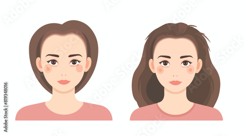 Woman before and after hair loss treatment or hair © Sofi