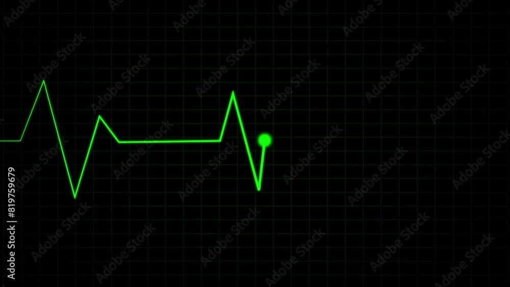 ECG cardiogram oscilloscope monitor. Pulse line shows heart rate on black background.Heartbeat lines animation background. ECG cardiogram oscilloscope monitor. Pulse line shows heart rate on black background.Heartbeat lines animation background.