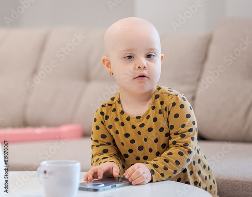 Baby girl with cancer and hair loss due to chemotherapy playing with a smartphone © bymandesigns
