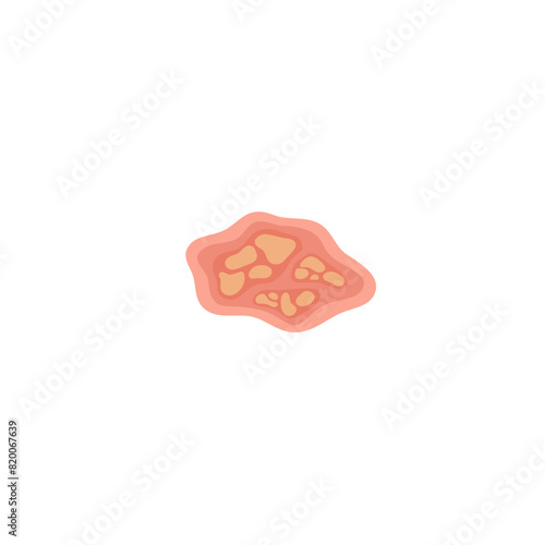 Human Parasites Coccodia Illustration 