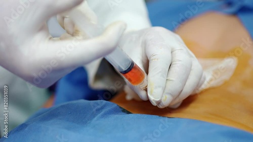 doctor administering an injection to a senior patient's spine as a treatment for sciatica pain and a back injury, professional chiropractor applying the injection into a vertebral space photo