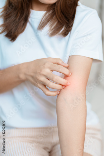 woman itching and scratching itchy arm. Sensitive Skin Allergic reaction to insect bite, food, drug dermatitis. Dermatology, Leprosy day, Systemic lupus erythematosus, Allergy symptoms and rash Eczema